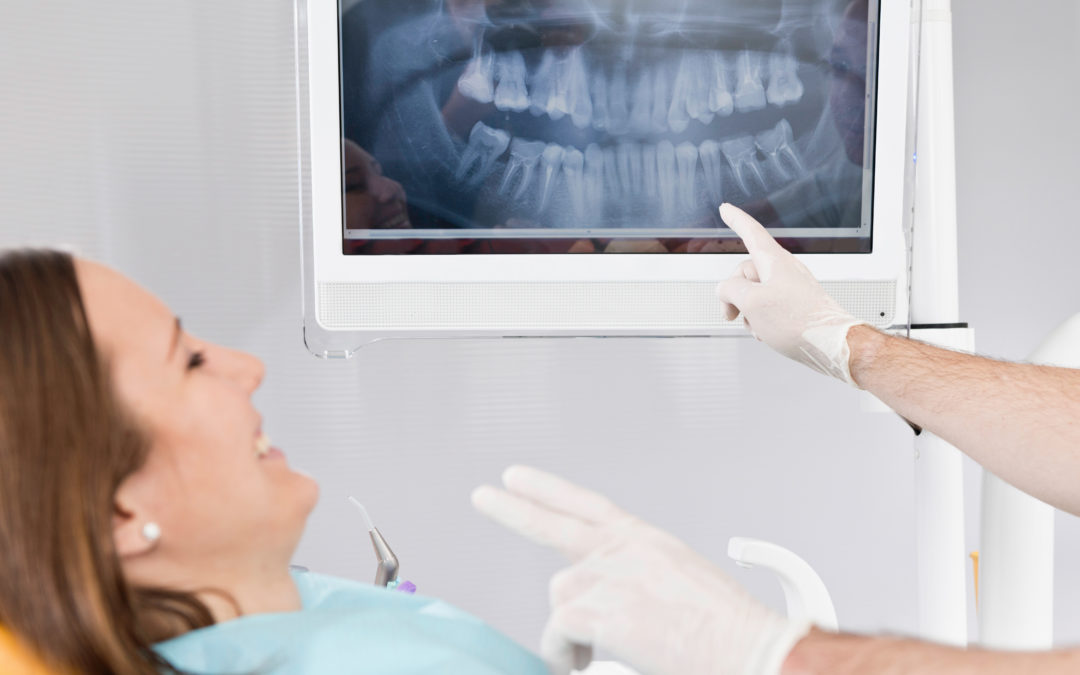 Uncovering the Truth About Dental X-Rays