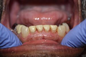 If You Don't Go to the Dentist