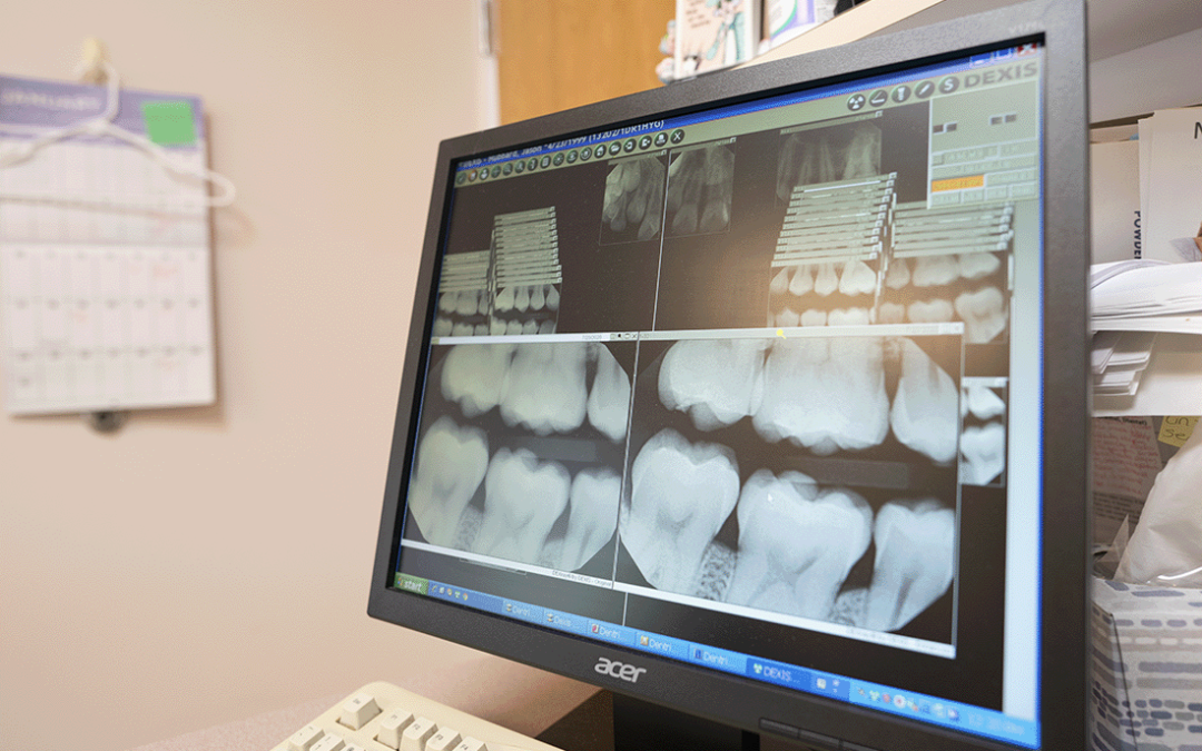 Dental X-Rays Work