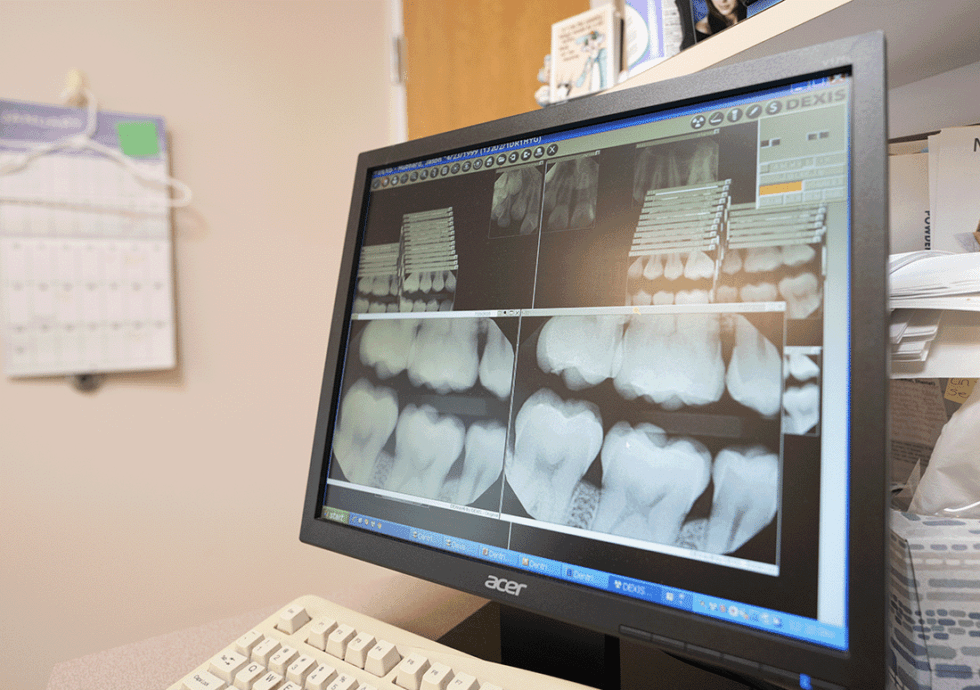 How and Why Dental XRays Work Mill Dam Dental Care