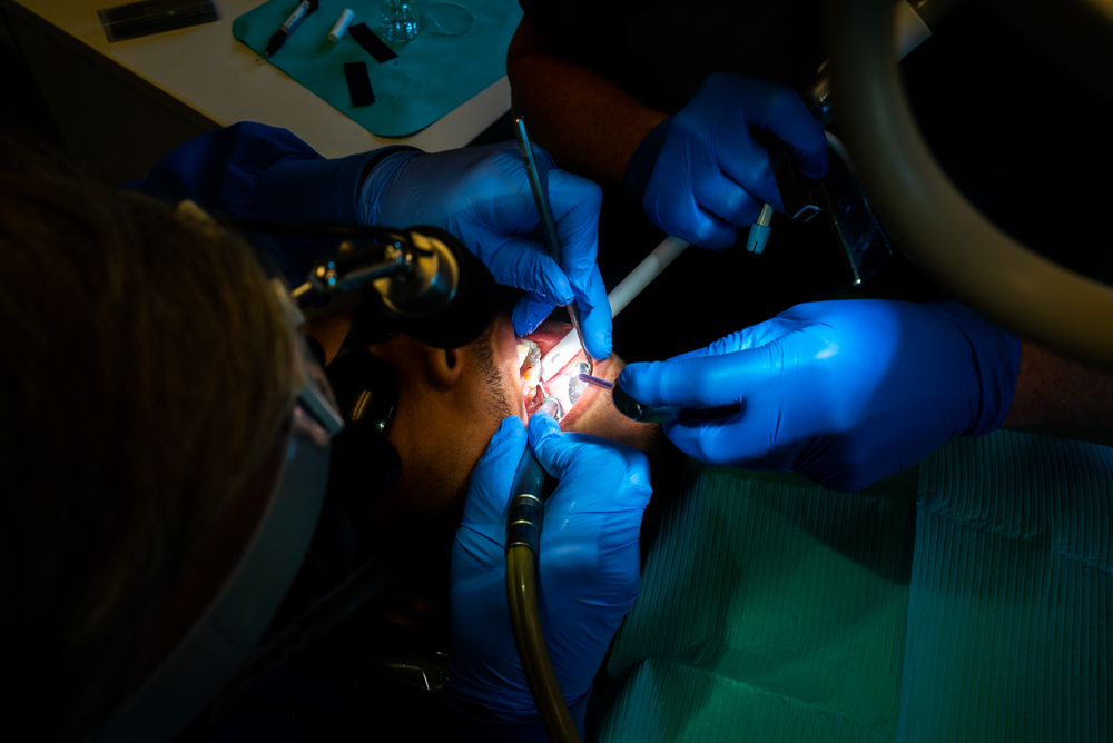 Laser Dentistry for Gum Disease