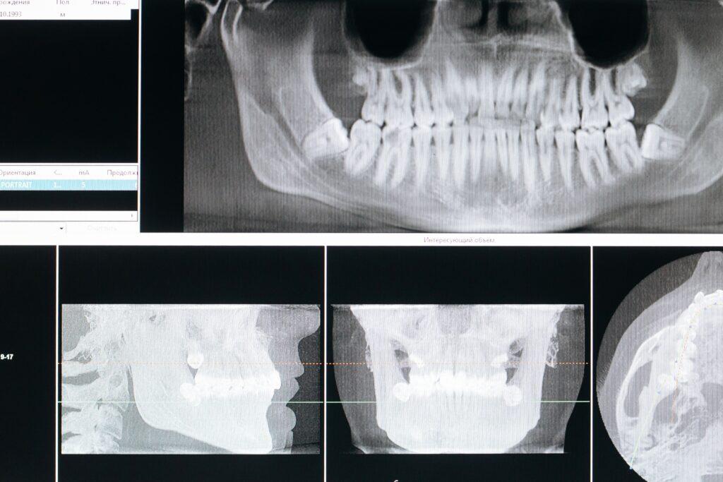 Genetics and Oral Health 