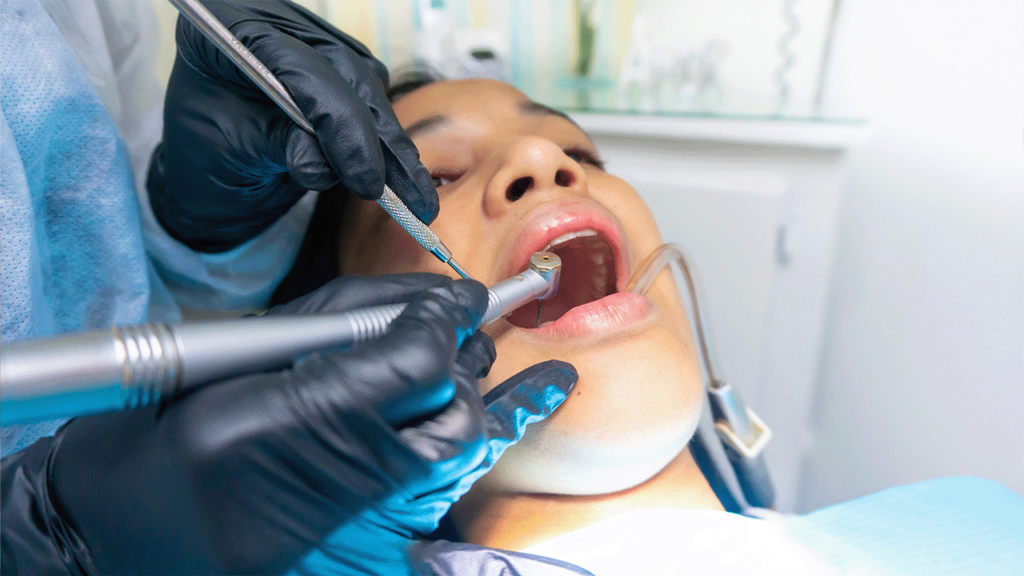 What Happens if a Cavity Goes Untreated Patient