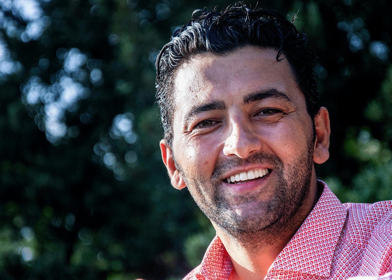 The Pros and Cons of Veneers Mill Dam Dental Care