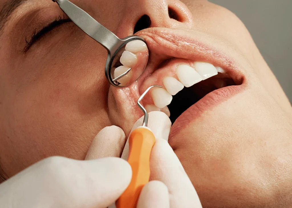 The Early Signs of Oral Cancer Check