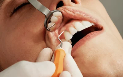 The Early Signs of Oral Cancer